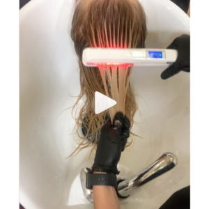 Well, This Looks Interesting: Laser Iron Treatment-img