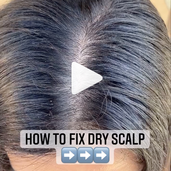 how to fix a dry or itchy or oily scalp surface awaken @hairbystevie