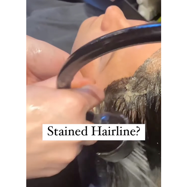 Stained Hairline Hacks You Need