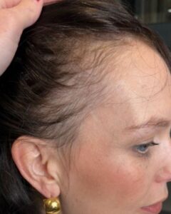 How Stress, Hormones and Nutrition Impact Hair Loss: What Hairstylists Should Know