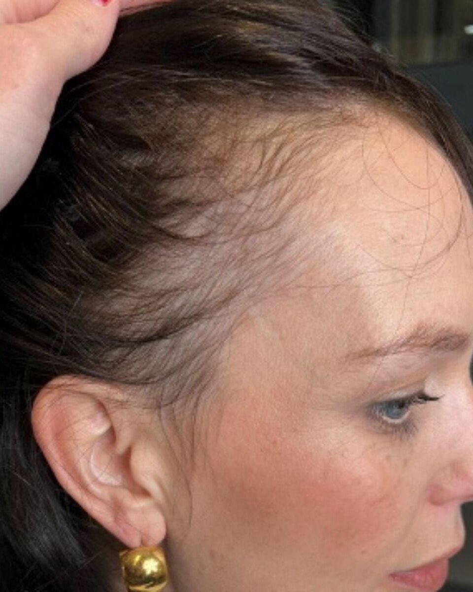 How Stress, Hormones and Nutrition Impact Hair Loss: What Hairstylists Should Know